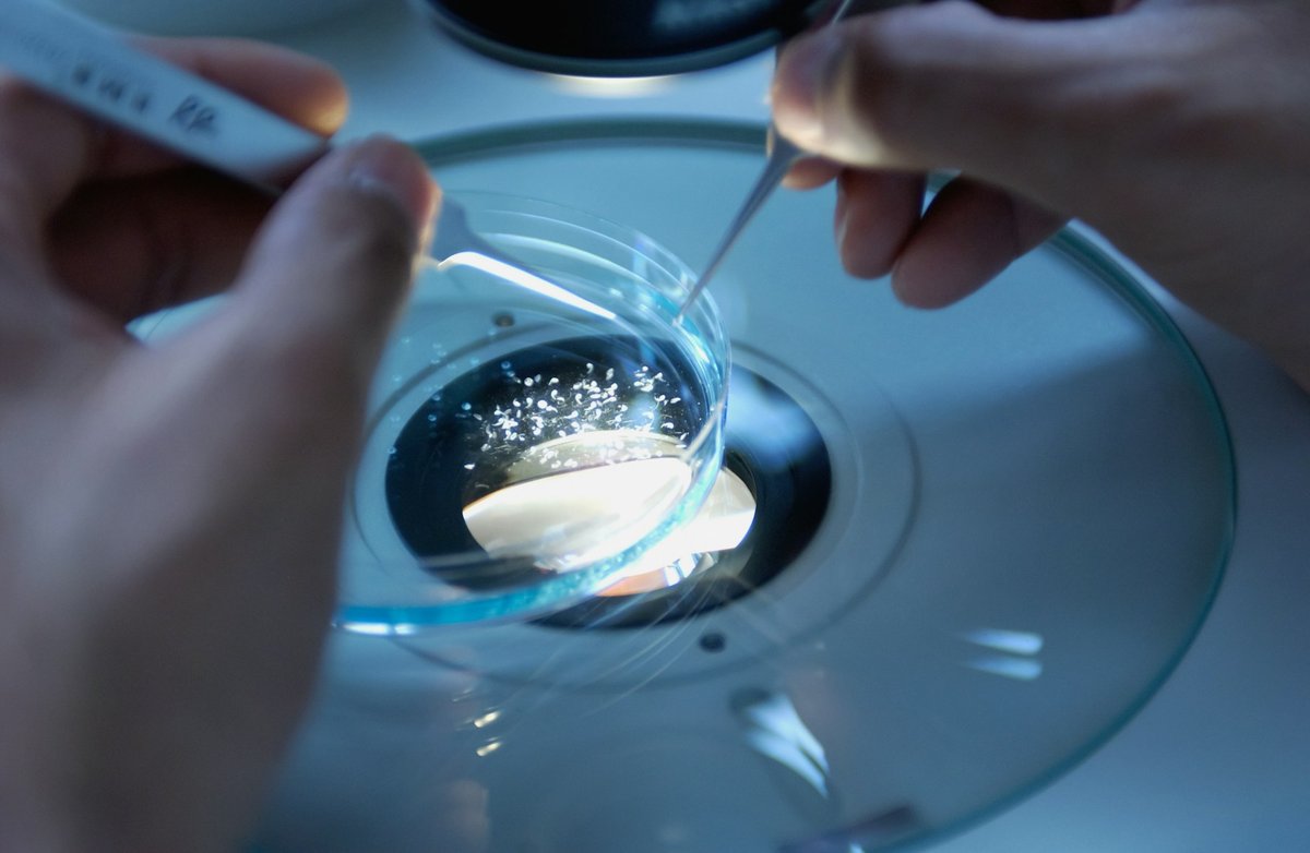 5 Surprising Realities of the AI Drug Discovery Revolution