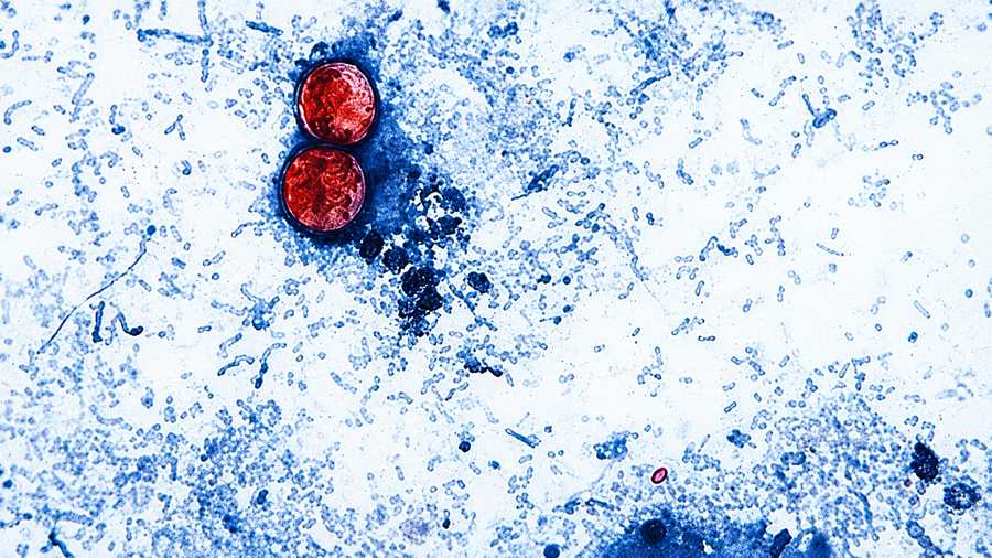 How to Stay Safe From Cyclospora