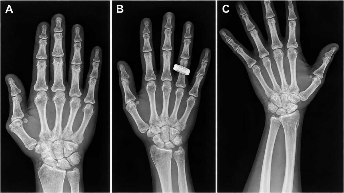 The First X-Rays Taken in Space