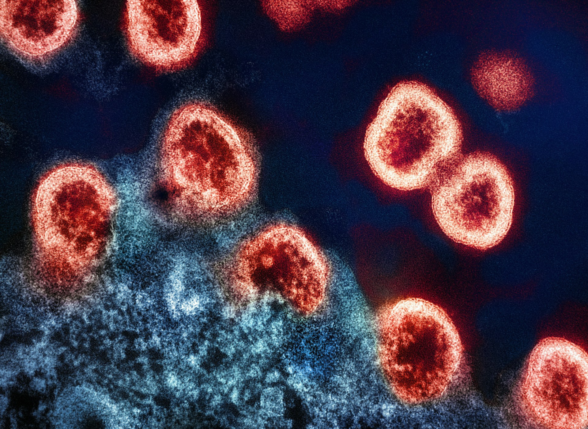 Infections Unsplash
