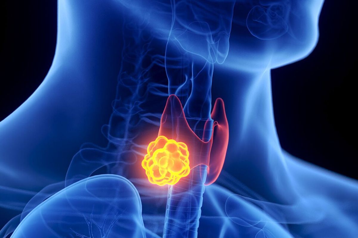 Thyroid Gland Diagram SciePro GmbH