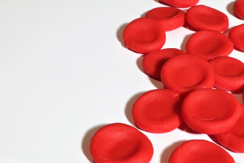 Anemia- Red Blood Cells - Haemoglobin